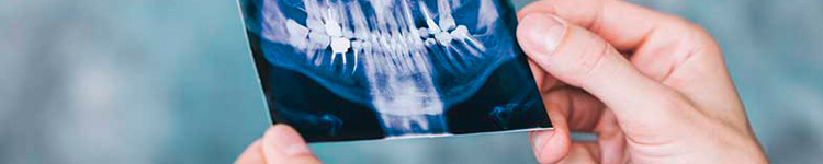 Рентген зубов в Тушино